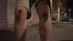 Las piernas del periodista del periódico 'La Stampa', Andrea Joly, tras ser agredido por militantes de ultraderecha en Turín.