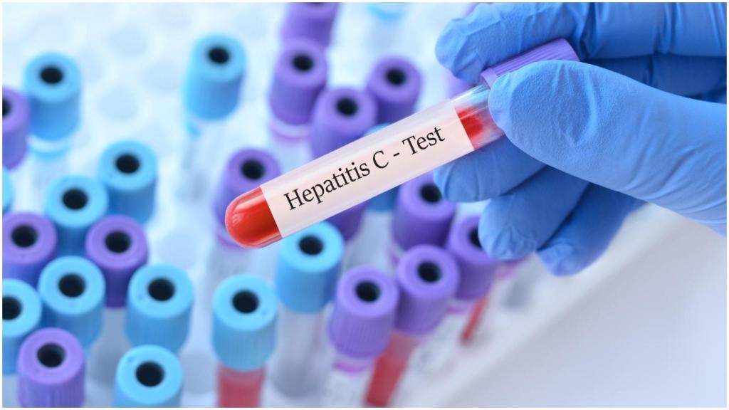 Una prueba de hepatitis C