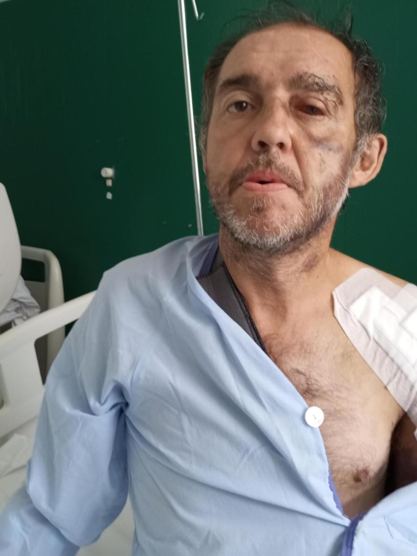 Alfonso Merino, este lunes, ingresado en el Hospital Santa Lucía de Cartagena.