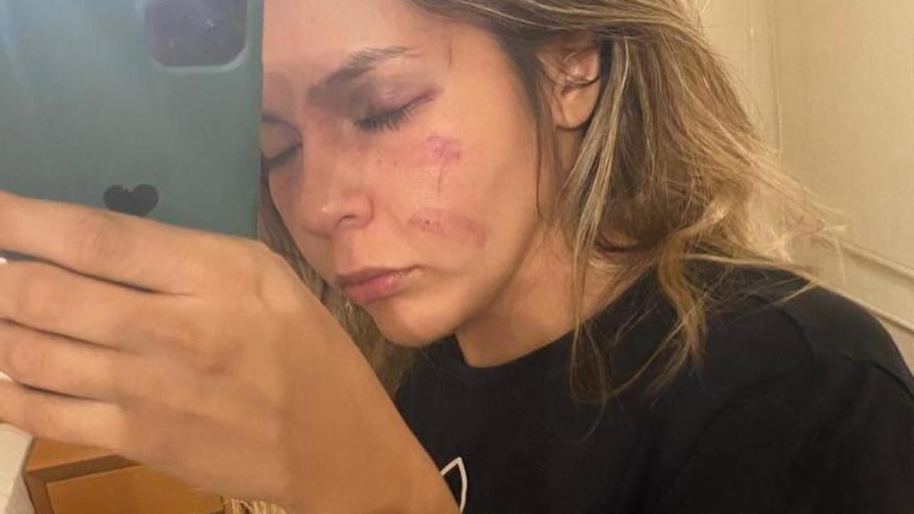El rostro de Brianda Tamara Cruz tras pelear frente a la argelina Imane Khelif