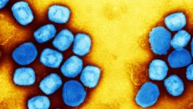 El virus mpox (azul) podría estar a punto de volver a provocar un brote mundial.