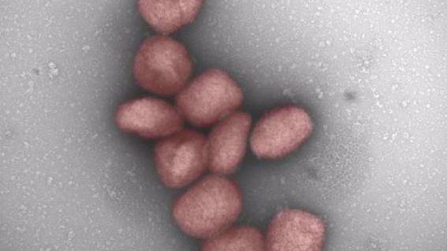 Un Estudio Del Csic Muestra La Presencia Del Virus De La Viruela Del Mono En El Aire Y En La Saliva De Pacientes Infectados