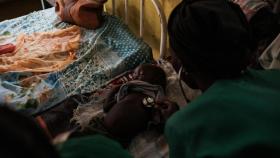 Una enfermera examina a Aziz Hussan, de 15 meses, en la sala de desnutrición del Hospital de Emergencia Alemán de Cap Anamur, cerca de Kauda, en los montes Nuba, el 15 de junio de 2024.  Guy Peterson / AFP | Cedida: World Vision