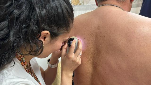 La incidencia de melanoma en Suecia es de 23 casos cada 100.000 habitantes.