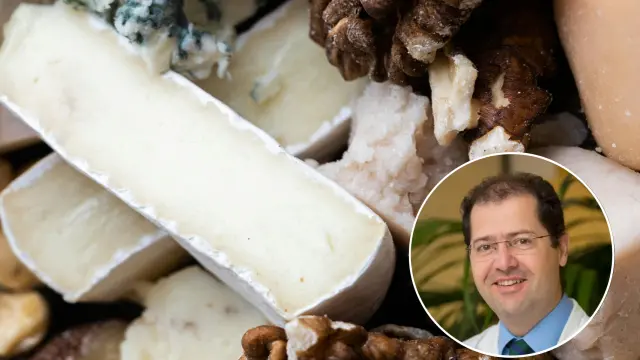 El queso y los frutos secos pueden provocar dolor, explica Pablo Irimia, neurólogo.