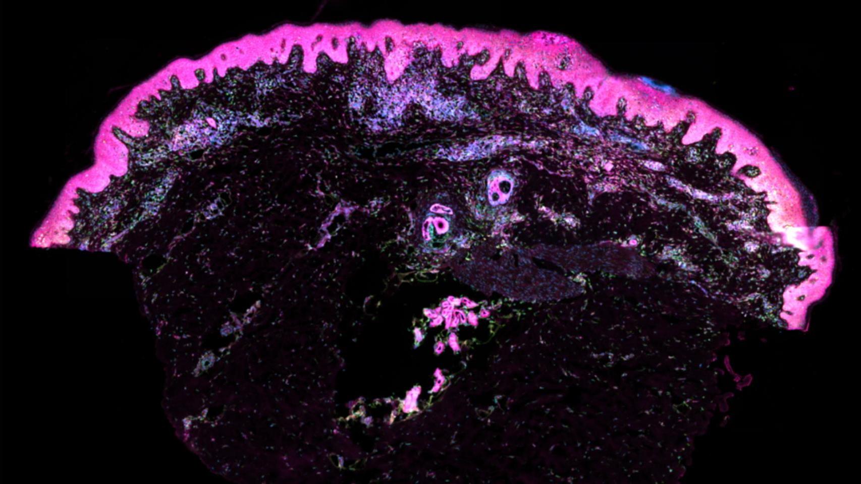 Segmentación celular en un corte transversal de piel humana. En rosa, la membrana, y en azul los nucleótidos. Wellcome Sanger Institute.