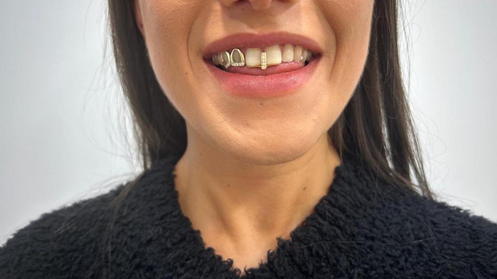 Boca con grillz.