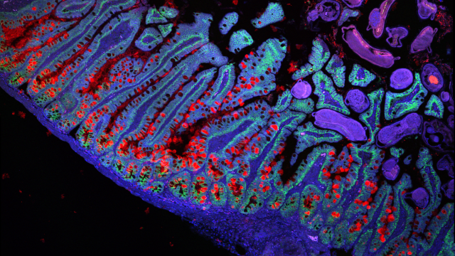 Las células del intestino delgado. Grace Burgin, Noga Rogel & Moshe Biton, Klarman Cell Observatory, Broad Institute.