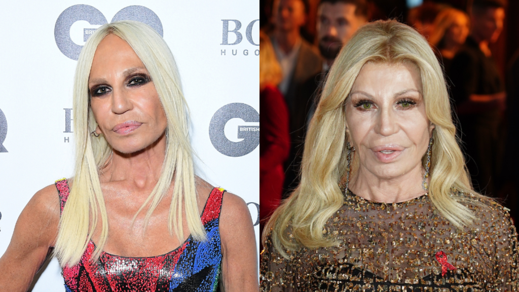 Donatella Versace, antes y después