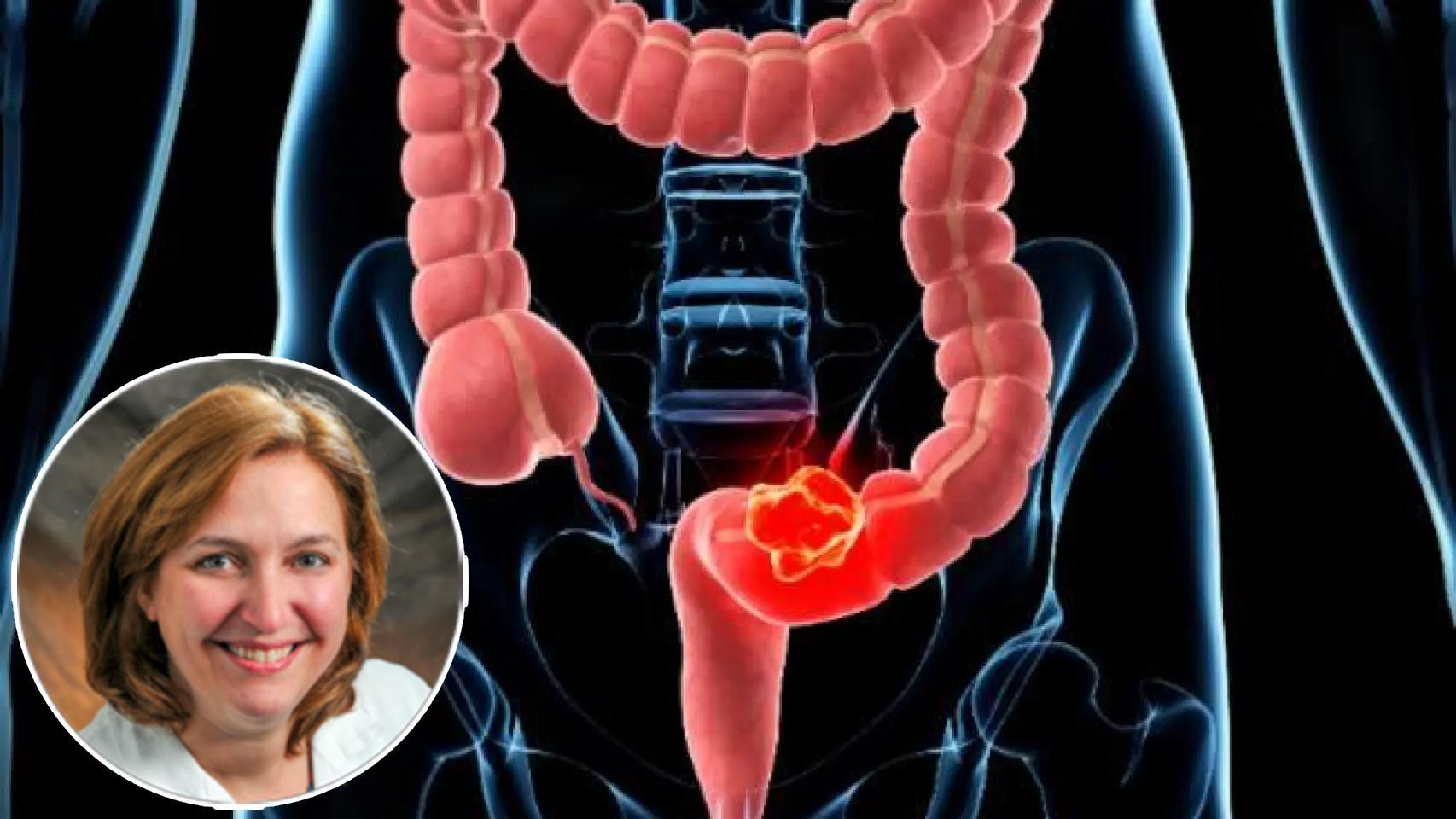 La oncóloga Ursina Teitelbaum es jefa de la sección de cánceres gastrointestinales en el  Centro Oncológico Abramson de Penn Medicine.