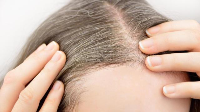 Mujer mostrando las canas de su cabello.