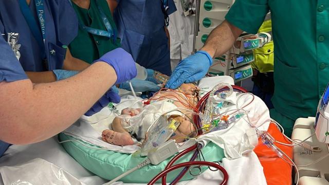 Profesionales del Materno Infantil utilizando la ECMO con un paciente.