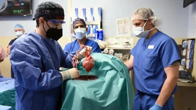 Médicos preparan un corazón de cerdo en uno de los primeros xenotrasplantes.