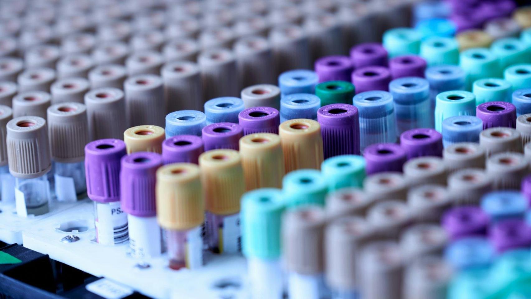 A new AI detects diseases analyzing the personal immunological footprint ‘