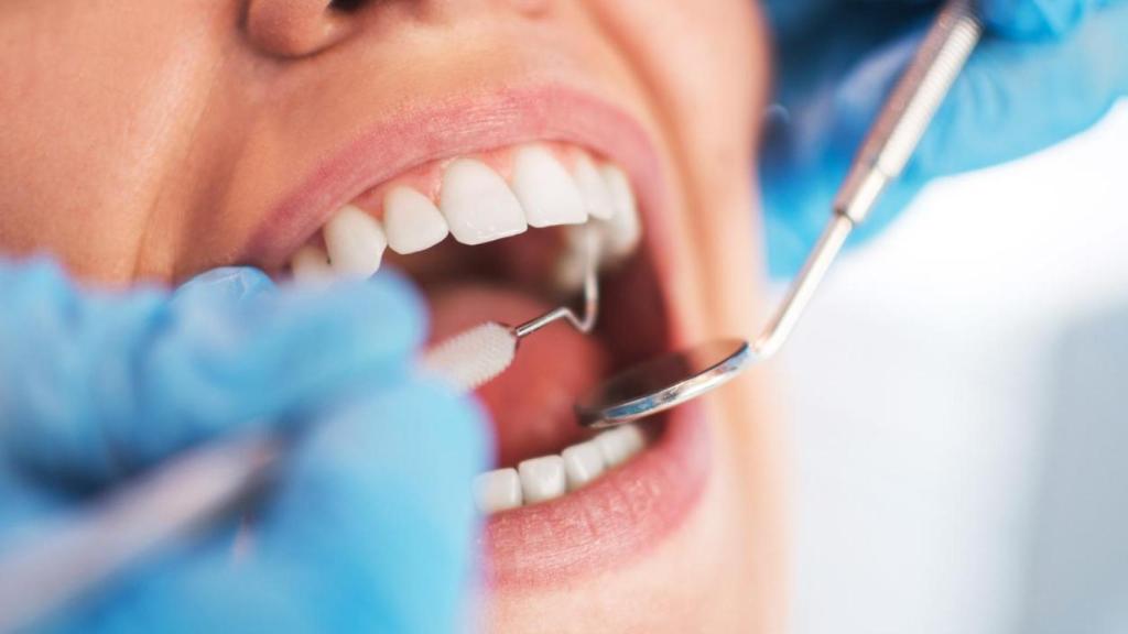 Mujer con la boca abierta durante un examen dental.