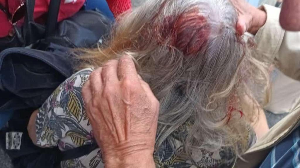 Una jubilada herida en la manifestación.