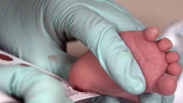 Imagen de archivo de un cribado neonatal.