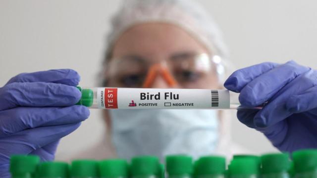 Un tubo con muestras de un paciente con gripe aviar.