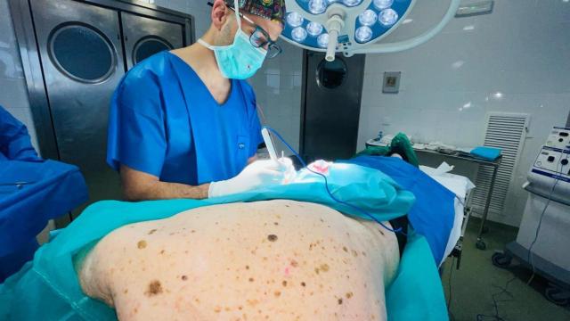 Una intervención quirúrgica contra el melanoma en el Virgen Macarena.