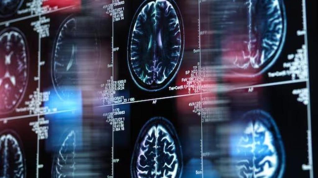 Actualmente unas 800.000 personas padecen alzhéimer en España.