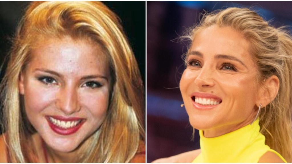 El antes y después de la actriz Elsa Pataky.