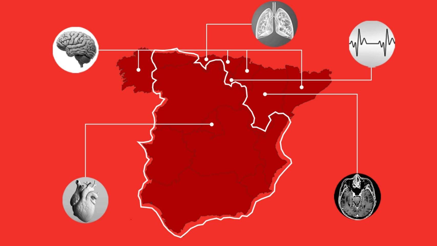 Dime en qué comunidad vives y te diré de qué es probable que mueras: estas son las cinco enfermedades que más matan