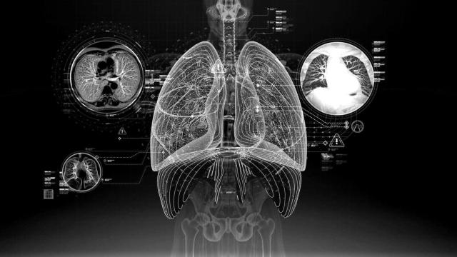 Sanidad e inteligencia artificial