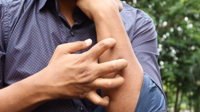 Una persona con una alergia cutánea.