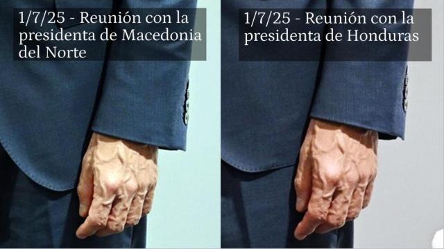 Imágenes de la mano izquierda de Pedro Sánchez obtenidas el 1 de julio, en Sevilla, durante sus reuniones con Gordana Silianovska-Davkova (Macedonia del Norte) y Xiomara Castro (Honduras).