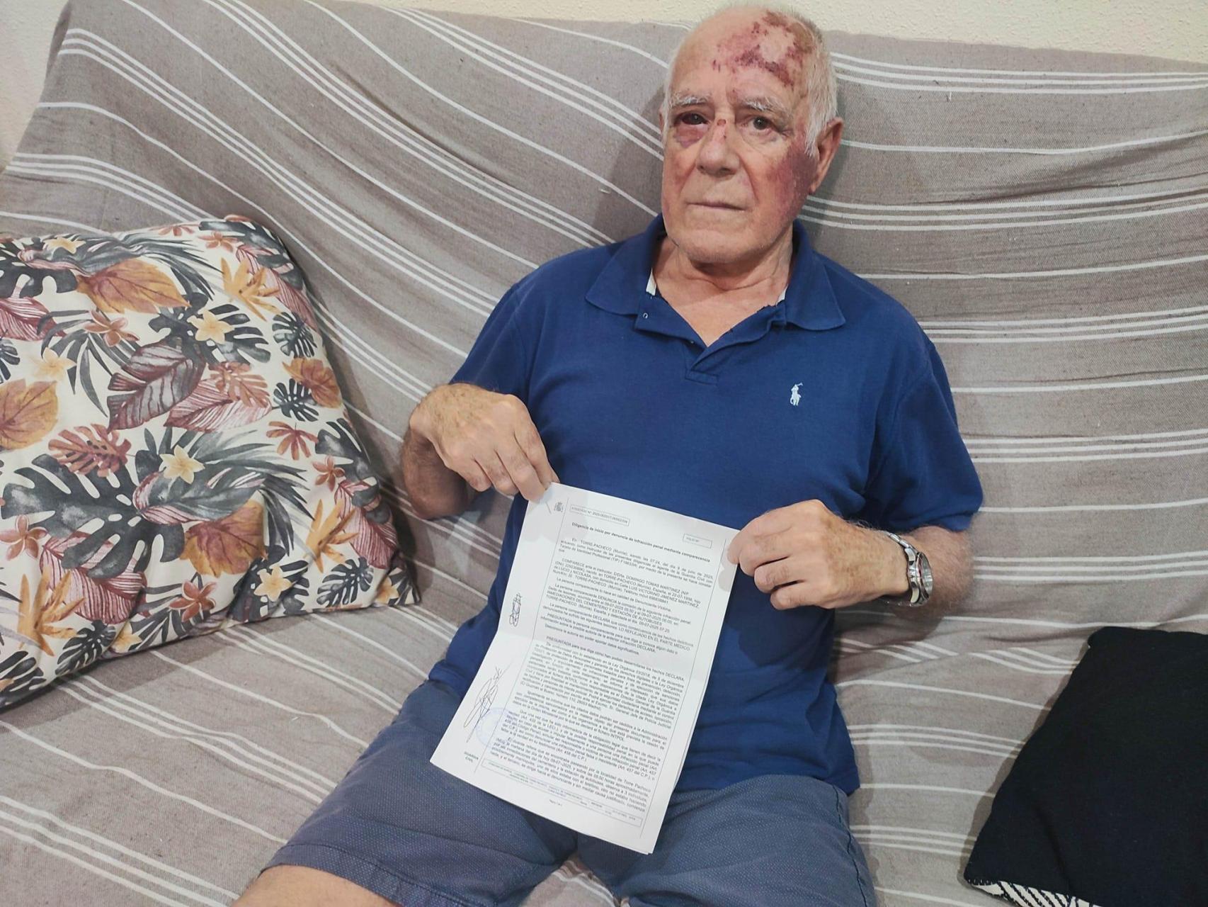 El drama de Domingo, el jubilado apaleado  por diversión  en Torre Pacheco:  Un chico me dio un estacazo y otros grabaron 