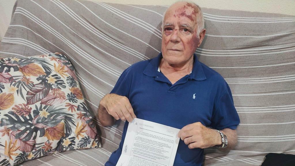 Domingo, este jueves, en el salón de su casa en Torre Pacheco, mostrando la denuncia que ha presentado por su agresión.