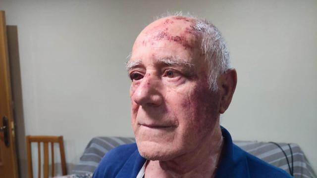 El rostro de Domingo, tras la agresión recibida en la localidad murciana.