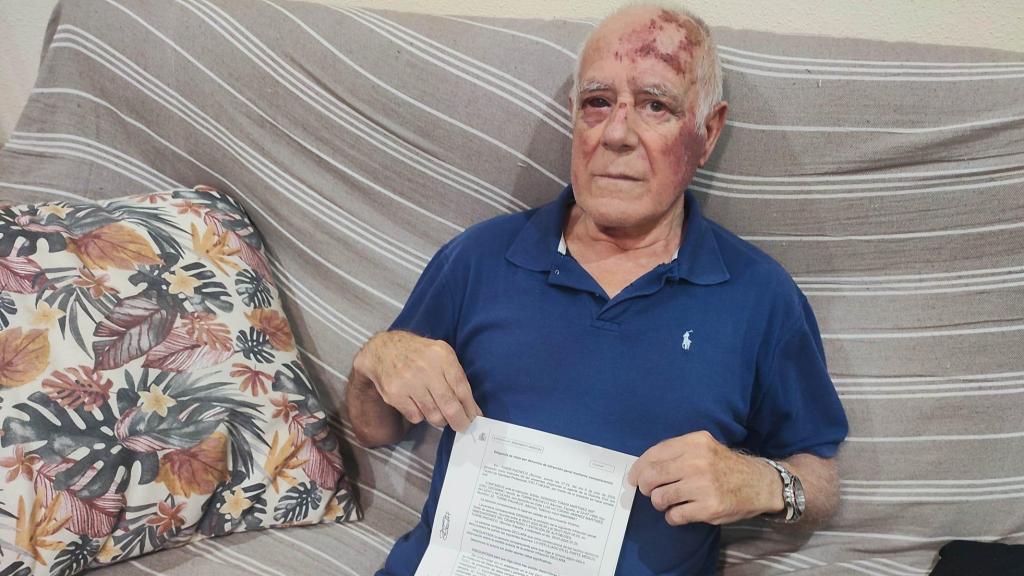Domingo, agredido por un joven marroquí, mostrando su denuncia en su casa de Torre Pacheco.