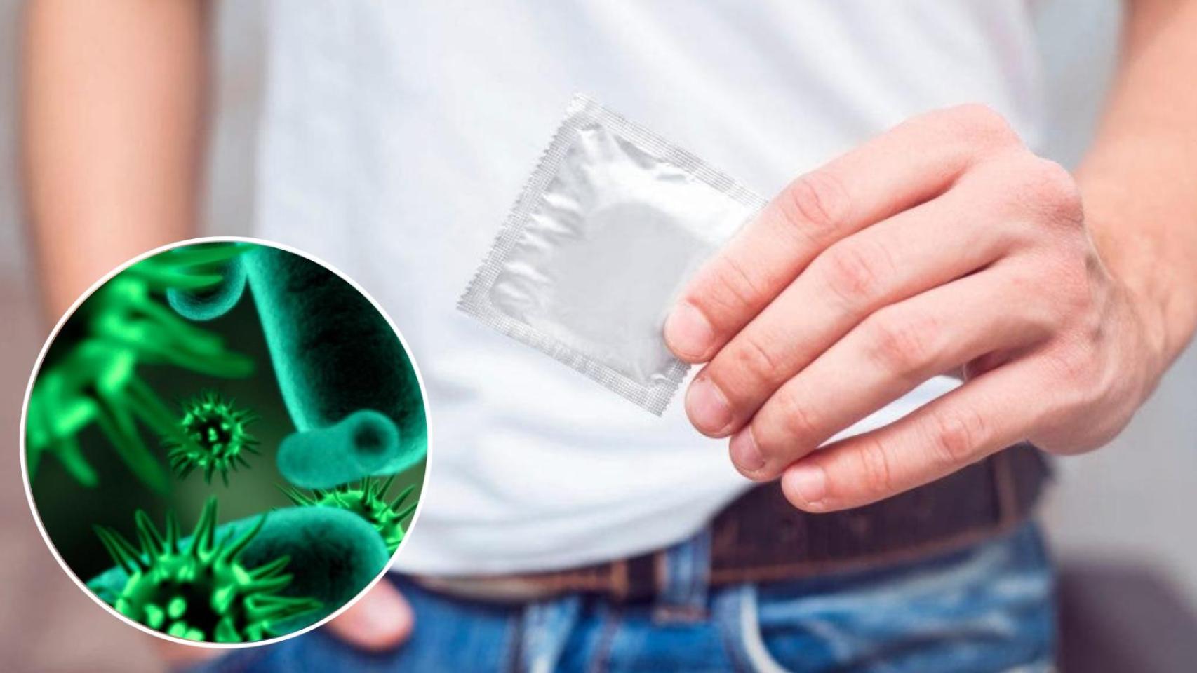 Los expertos alertan del auge de nuevas bacterias transmitidas por vía sexual en España: de la Shigella a las hepatitis C