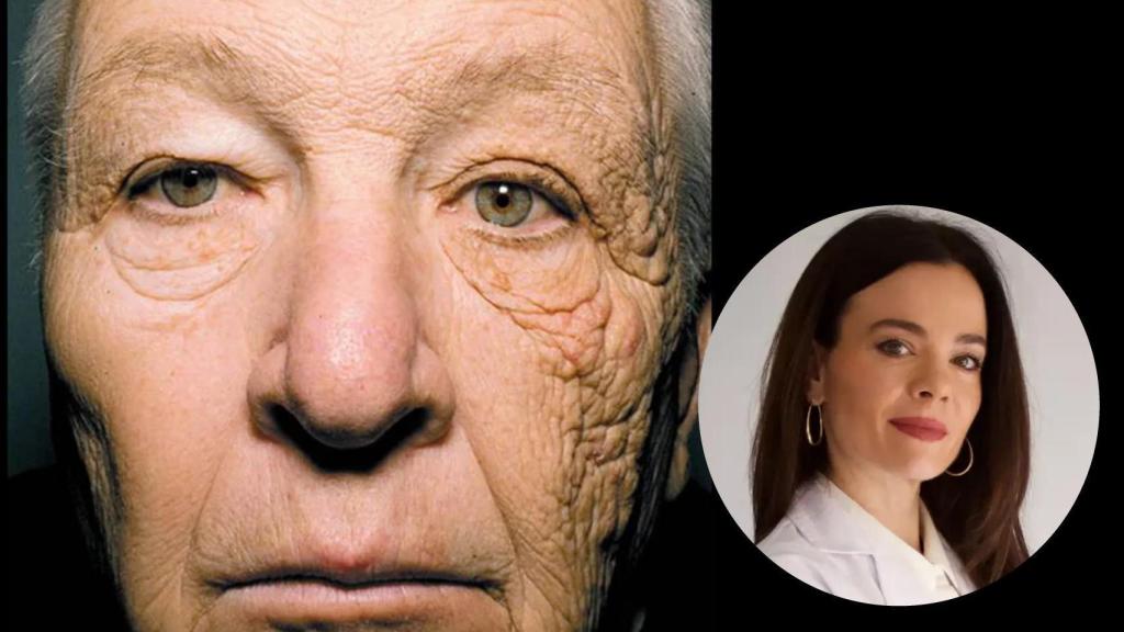 Helena Rodero explica la famosa fotografía del camionero afectado por la radiación ultravioleta.