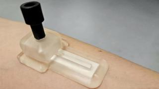 Adiós a los análisis de sangre: el parche que examina tu salud durante horas sin necesidad de baterías ni pinchazos